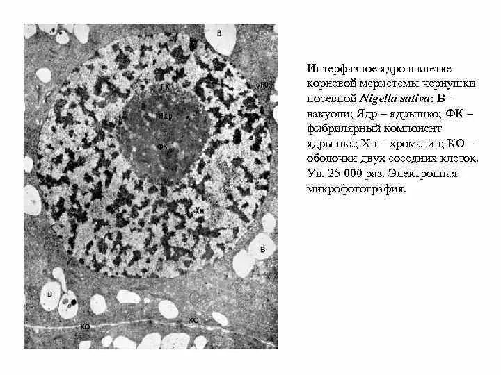 Интерфазное ядро. Компоненты интерфазного ядра клетки. В ядре интерфазной клетки. Интерфазное ядро в секреторных клетках кожи. Интерфазное ядро клетки.
