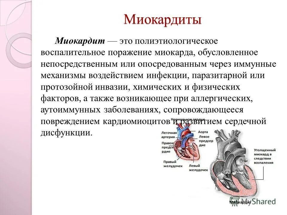 Одышка миокардит. Одышка миокардит. Одышка миокардит. Миокардит симптомы. Острый инфекционный миокардит.
