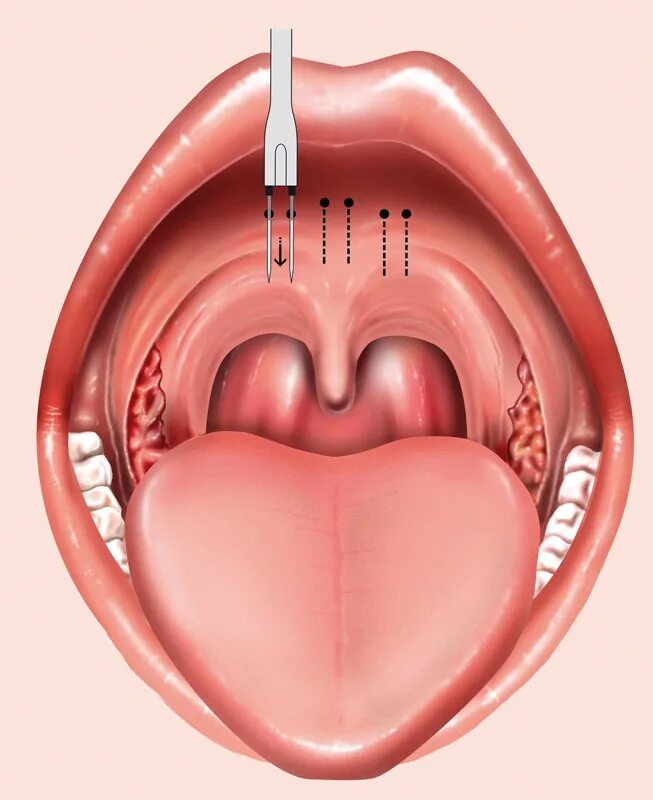 небо здорового ребенка
