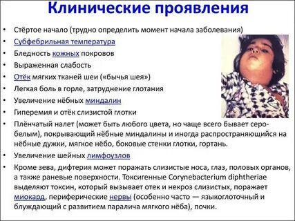 Заболевание всегда сопровождается выраженными проявлениями