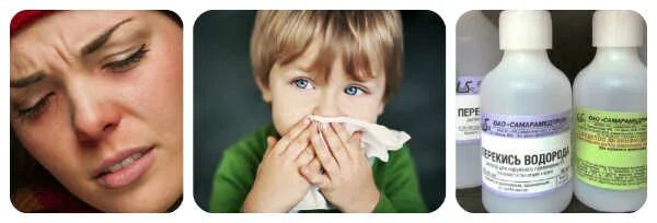 Перекись от насморка. При заложенности носа у ребенка. Перекись водорода в нос при насморке взрослым. Народные средства от заложенности носа у детей.