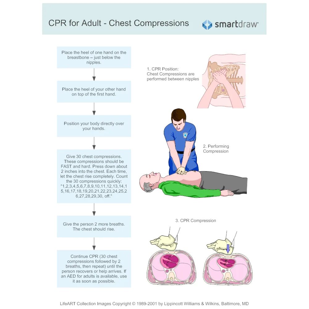 Паттерн CPR. Методология CPR что это.