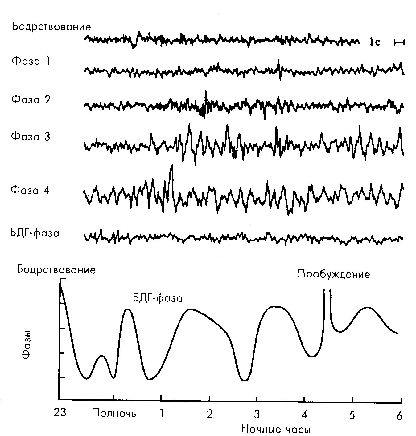 Тест фазы сна. Электроэнцефалограмма медленного и быстрого сна. Фазы сна у ребенка 2 года. Тест фазы сна. Тест фазы сна.