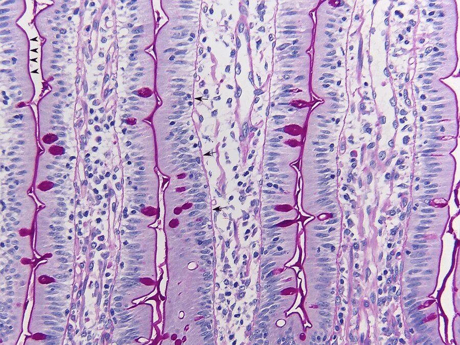 Бокаловидная клетка гистология. Бокаловидные клетки кишечника гистология. Бокаловидные клетки пищевода. Щеточная каемка. Клетки пищевода