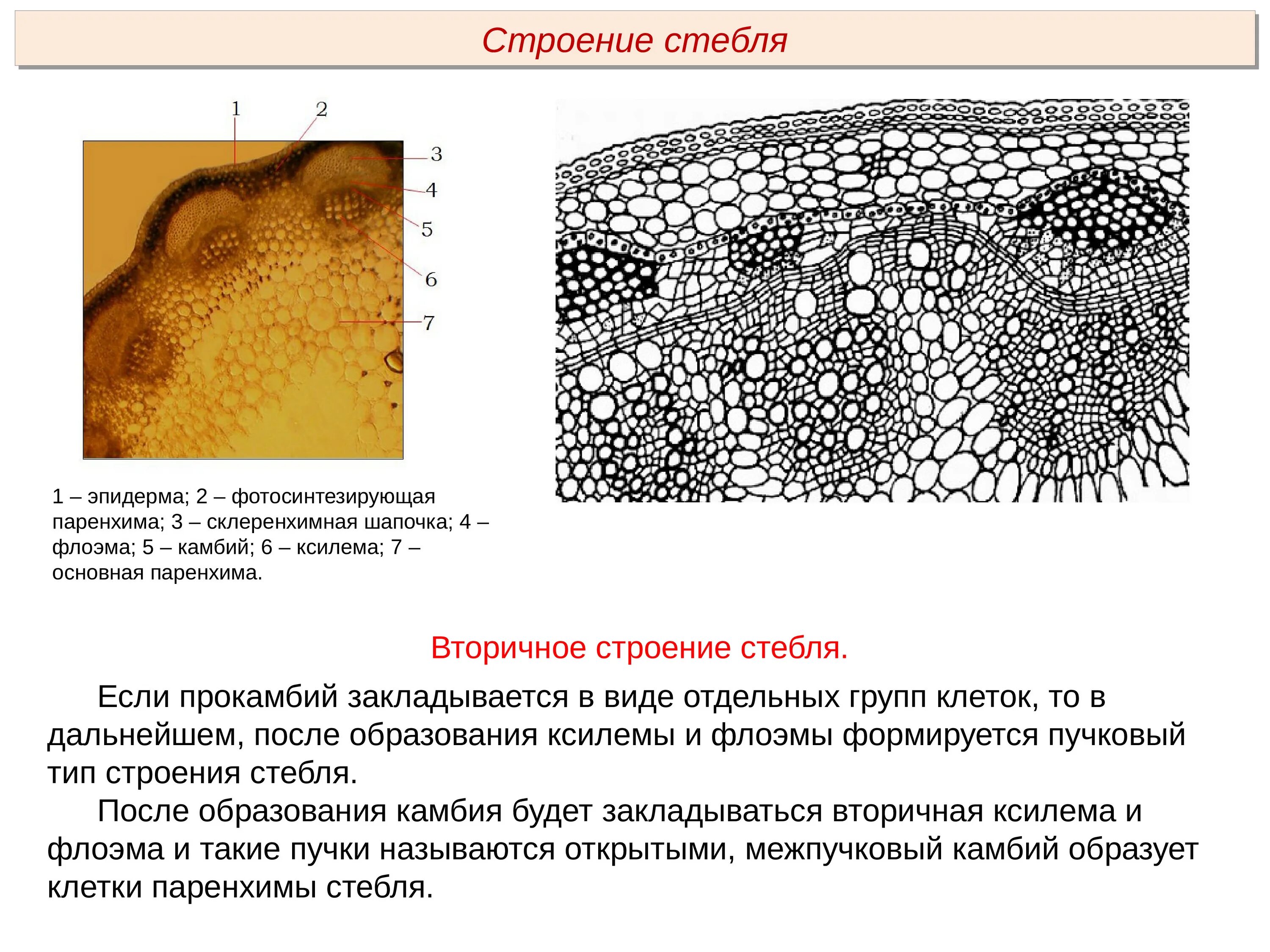 Из чего образовывается склеренхимная шапочка. Склеренхима ткань растений. Склеренхима растений под микроскопом. Склеренхима на поперечном срезе стебля тыквы обыкновенной. Клеточное строение стебля.
