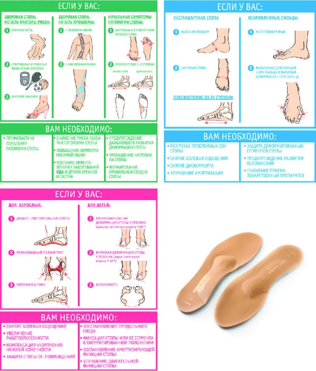 Как выбрать ортопедические стельки. Виды ортопедических стелек и их классификация. Как правильно выбрать ортопедические стельки. Как правильно подобрать ортопедические стельки. Как правильно подобрать стельки