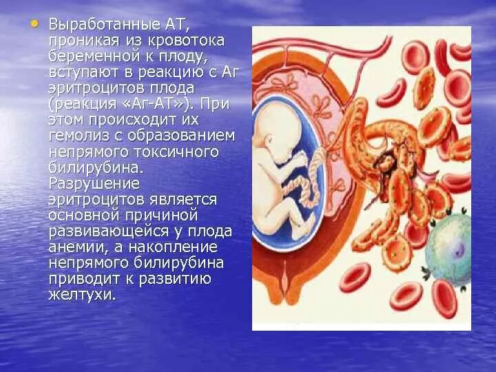 Нарушение гемодинамики при беременности. Нарушение кровообращения плода. гемодинамика у беременных.