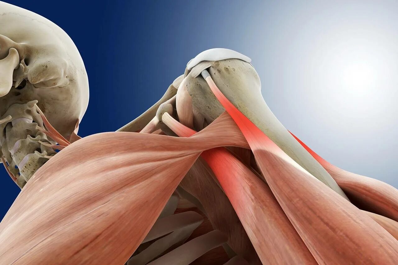 Травмы мышц и сухожилий. Ротаторная манжета плечевого сустава мышцы. Тендинопатия сухожилия мышцы. Тендинопатия сухожилия плечевого сустава. Тендопатия сухожилия надостной мышцы.