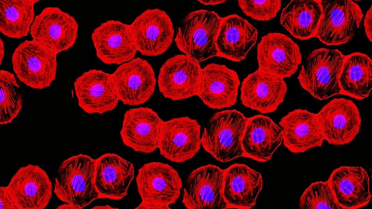 1 стволовые клетки. Кроветворные стволовые клетки под микроскопом. Эмбриональные стволовые клетки под микроскопом. Гемопоэтические стволовые клетки под микроскопом. Стволовая клетка под микроскопом.