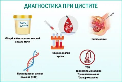 Боль при мочеиспускании анализы