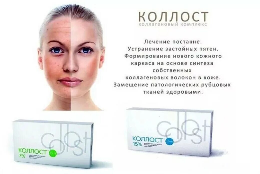 Микроколост