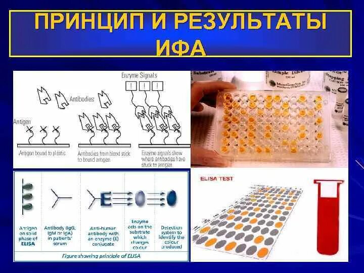 Произвести учет результатов ИФА при диагностике ВИЧ- инфекции. Схема постановки реакции ИФА. Метод ИФА на ВИЧ. Метод иммуноферментного анализа (ИФА).. Тест ифа 4