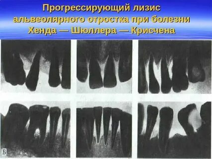 Папийона лефевра