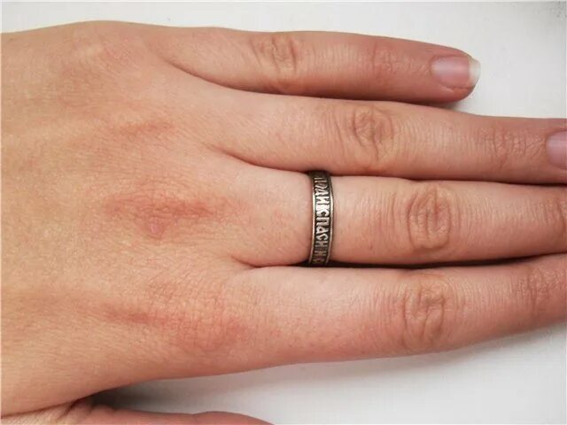След от золотого кольца почему. Серебряное кольцо темнеет. Потемнения от кольца. Почерневшее серебряное кольцо.