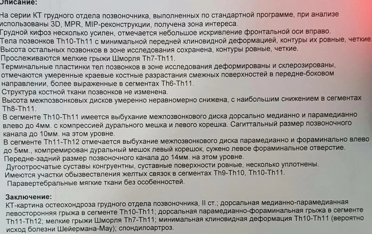 Заключение при грыже позвоночника. Диагноз грыжа позвоночника. Заключение невролога остеохондроз. Диагнозы поясничного отдела позвоночника.