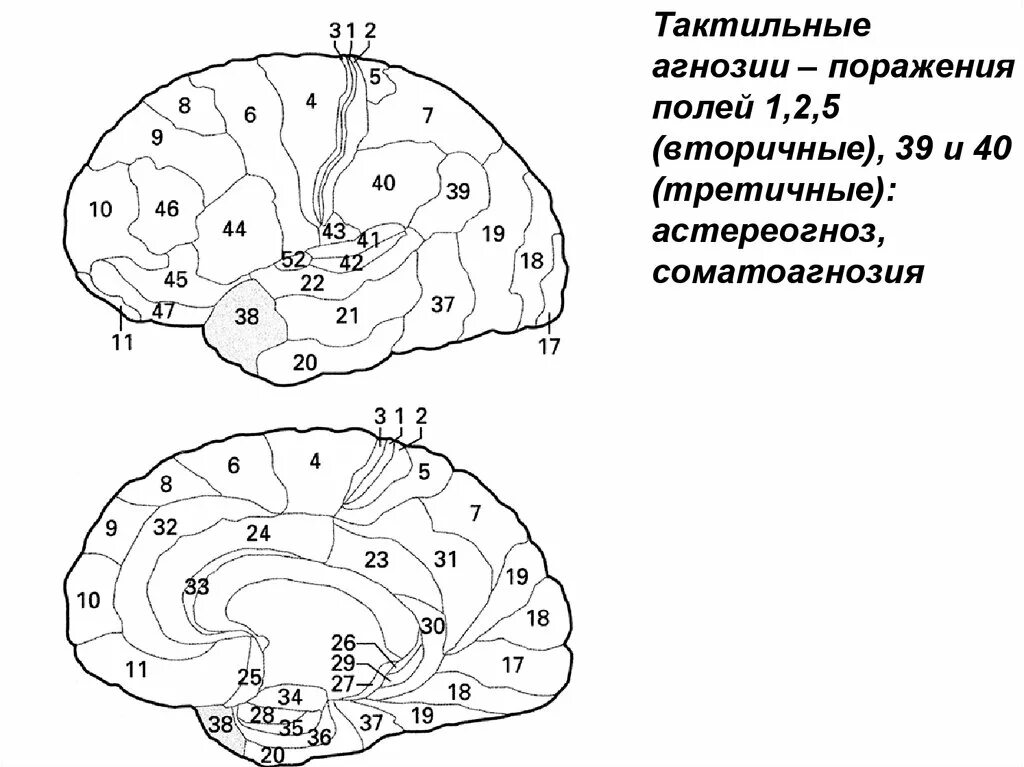 Тактильная агнозия поля Бродмана. Тактильная агнозия локализация поражения. Зрительная агнозия очаг поражения. Тактильные агнозии возникают при повреждении. Третичные поля мозга