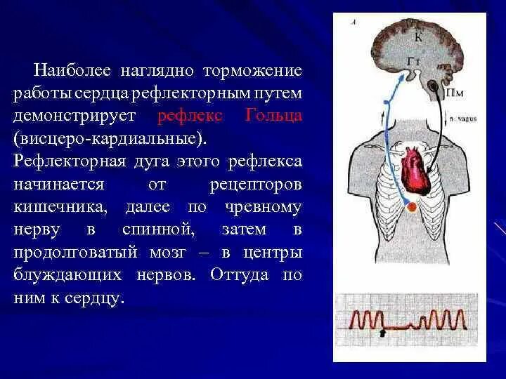 Сеченов торможение рефлексов. Рефлекс погружение. Рефлекс нормальная физиология. М. Механизм торможения в опыте сеченова.