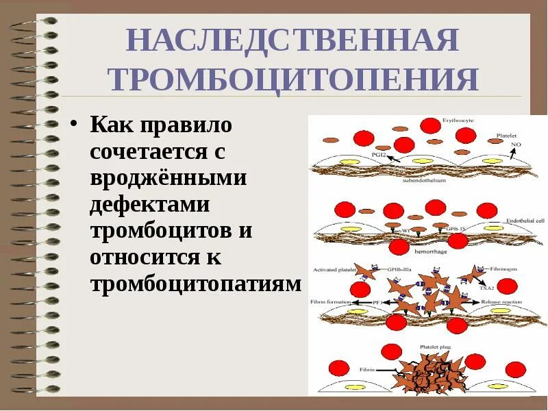 Тромбоцитопения что это симптомы. Наследственная тромбоцитопения. наследственные тромбоцитопатии. тромбоцитопении и тромбоцитопатии.