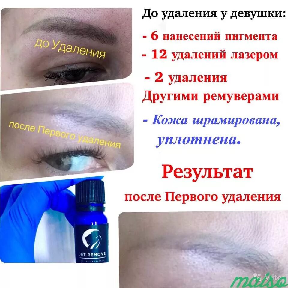 Ремувер для удаления татуажа бровей