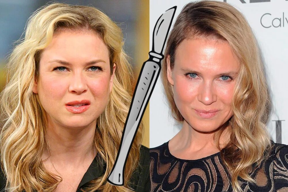 Рене зеллвегер пластическая операция. Рене зеллвегер до и после. Рене зеллвегер до и после пластики. Рене зельвегер пластика. Рен после пластики.