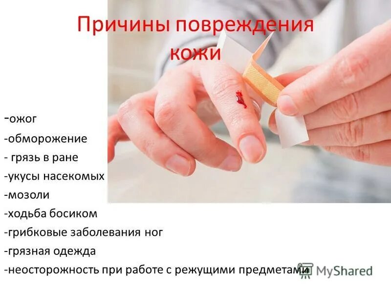 причины повреждения кожи. нарушение кожных покровов и повреждение кожи. причины повреждения кожи. причины нарушения кожных покровов. причины нарушений кожных покровов таблица.