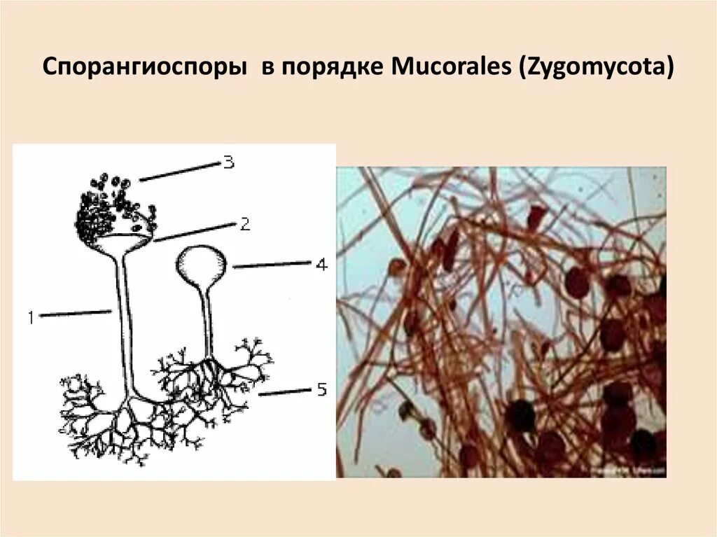 Примеры мукора. Мукор ризопус. Спорангиоспоры мукора. Mucorales – мукоралес. Спорангиоспоры и конидии.