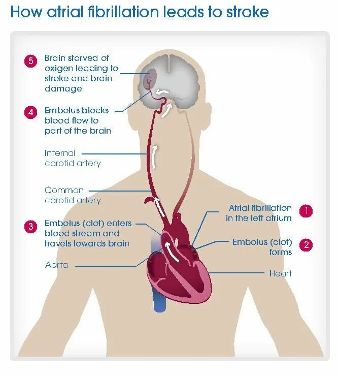 How to stroke