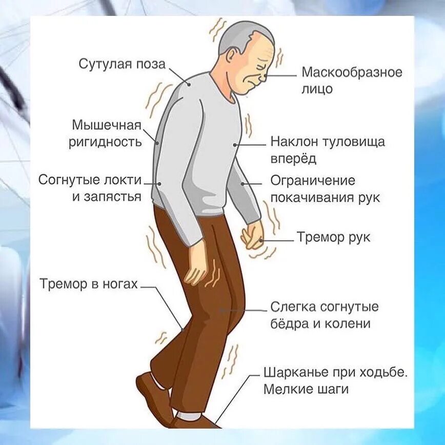 Болезнь паркинсона симптомы. Болезнь паркинсона формулировка. Тяжелый паркинсон. Тяжелый паркинсон. Продолжительность болезни паркинсона.