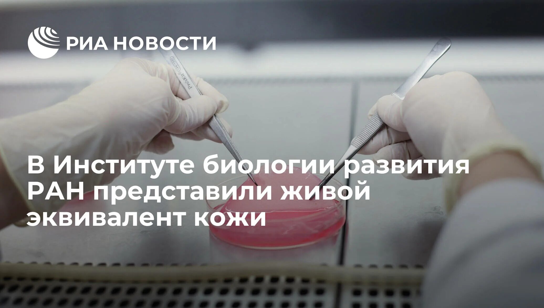 Эквивалент кожи. Напечатанная кожа. Передачи из рук в руку креатив. Дермальный эквивалент кожи после. Белки стволовых клеток.