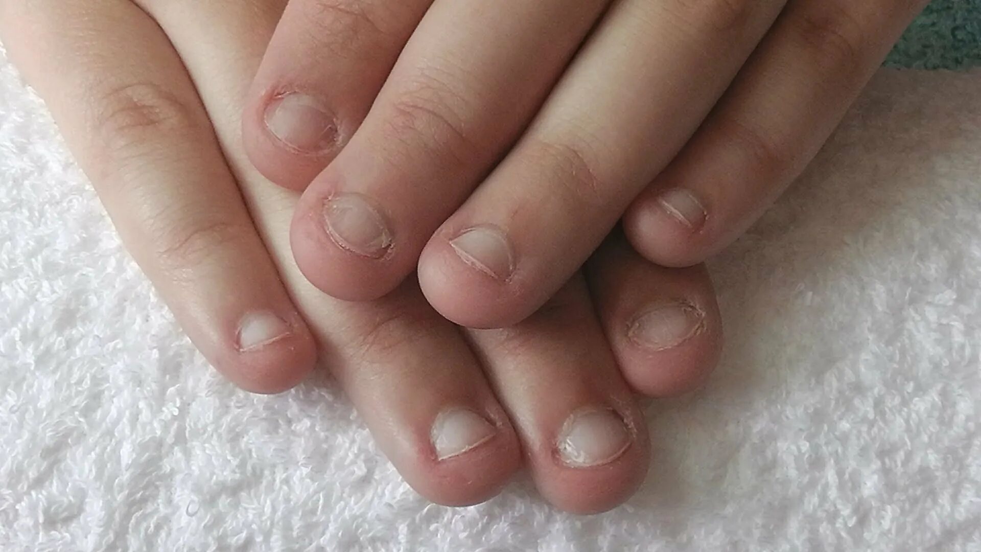 Ногти грызунов. Ногти грызунов. Маникюр крыса на ногтях. Наращивание на ногти грызунчика. Кролик морская свинка крыса шиншилла.