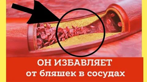 Как избавиться от бляшек