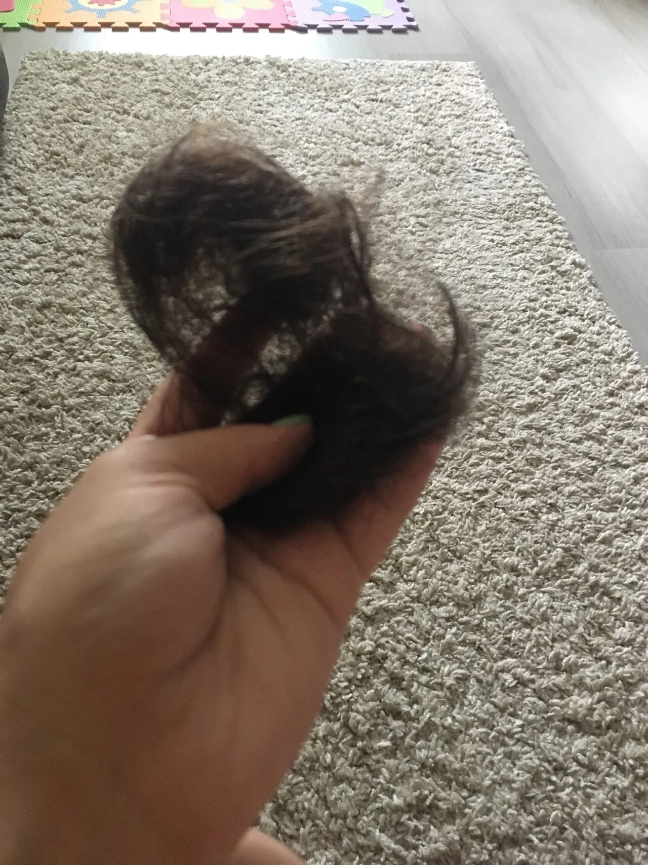 Сильно выпадают волосы после родов. Послеродовая алопеция. После родов выпадают. Выпадение волос у женщин после родов. После родов выпадают.