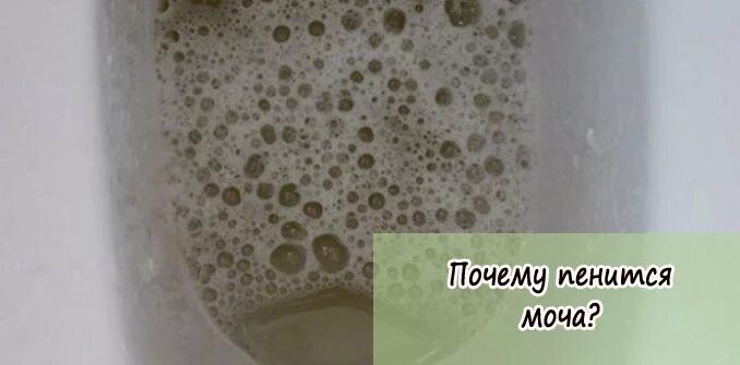 Пенится моча у мужчины причины