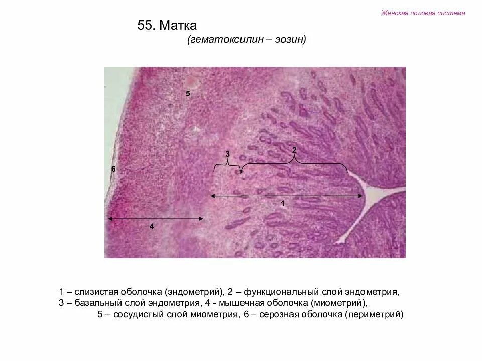 Слизистая стенок матки. Матка окраска гематоксилин эозин. Гематоксилин эозин гистология. Матка фаза покоя гистология препарат. Матка гистология препарат.