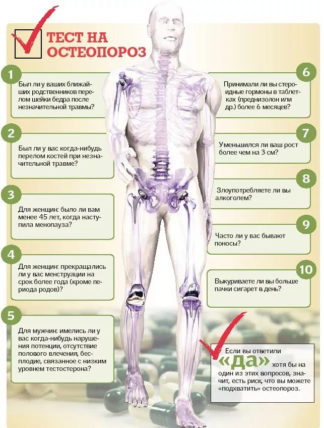 Остеопороз симптомы. Тест на остеопороз. Признаки остеопороза. Симптомы при остеопорозе.
