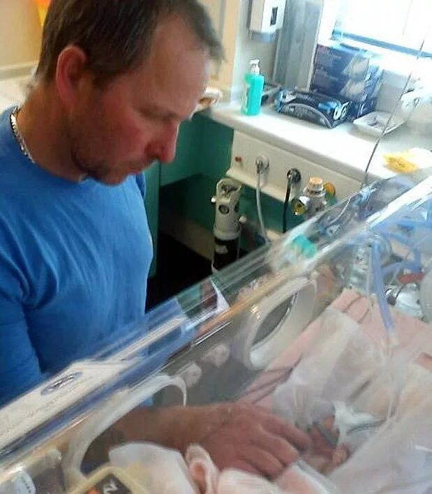 Родился в англии. Рождение недоношенных детей. Новорожденный 24 недели. Самый недоношенный ребенок.