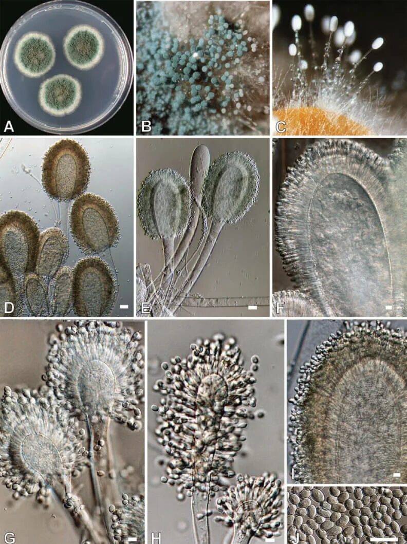 Споры грибов семена. Aspergillus clavatus. Aspergillus oryzae. Клейстотеций аспергилла. Плесневые грибы аспергиллус.