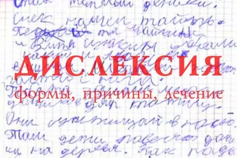 Дисфлексия