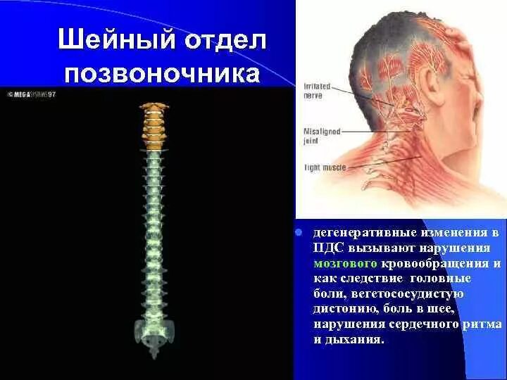 Функции шейного отдела. Дегенеративные изменения шейного отдела. Дистрофические изменения шейного отдела. Дегенеративно-дистрофические изменения шейного отдела. Дегенеративные изменения шейного отдела позвоночника.