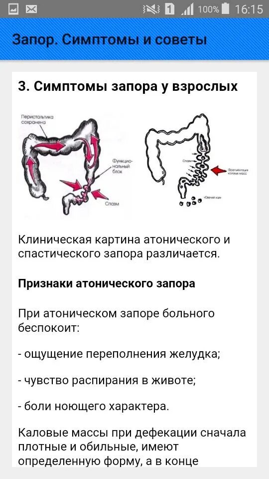 Время опорожнения кишечника. Запор. Симптоматика запора. Клинические проявления запора. Причины запора.