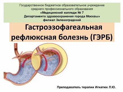 Гэрб это простыми