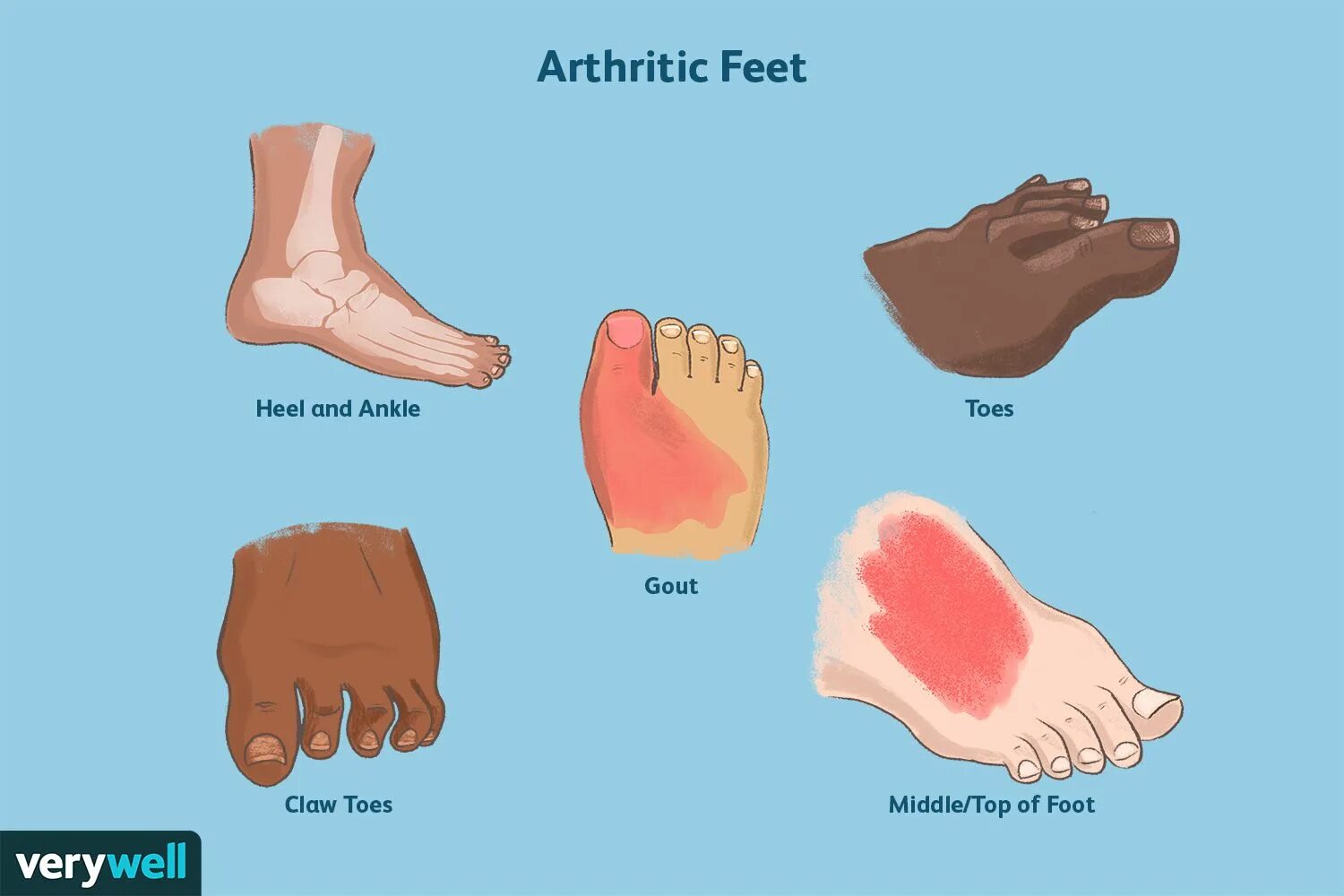 Ten toes. Ten toes. Ten toes. Smile-close up. Ten toes.