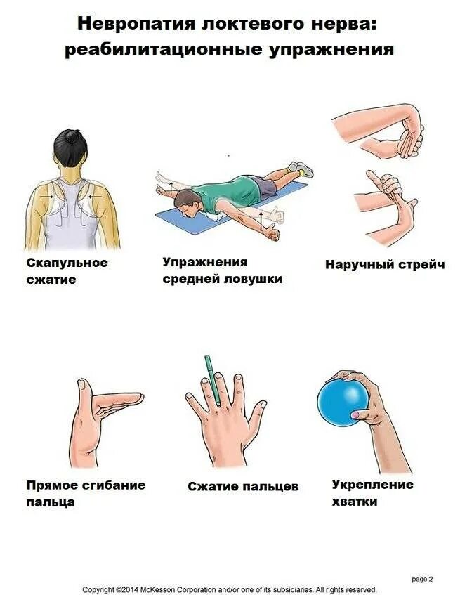 Неврит лучевого нерва ЛФК. Туннельный синдром локтевого нерва. При поражении локтевого нерва. Невропатия локтевого нерва лечебная физкультура.