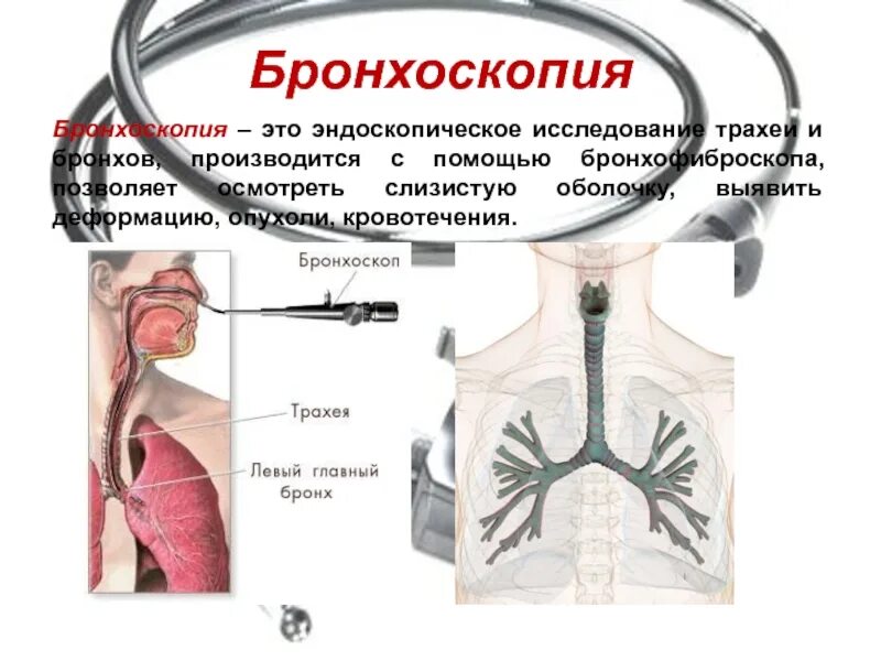 Бронхоскопия какой метод