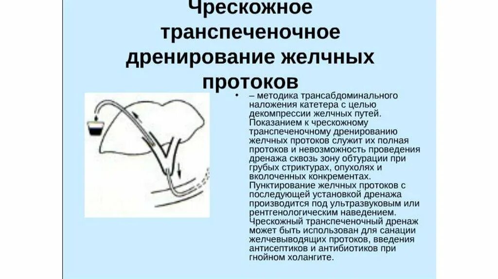 Дренирование желчного пузыря. Чрескожная чреспеченочная дренирование желчных протоков. наружно-внутреннее дренирование желчных протоков. наружное и внутреннее дренирование желчных путей.