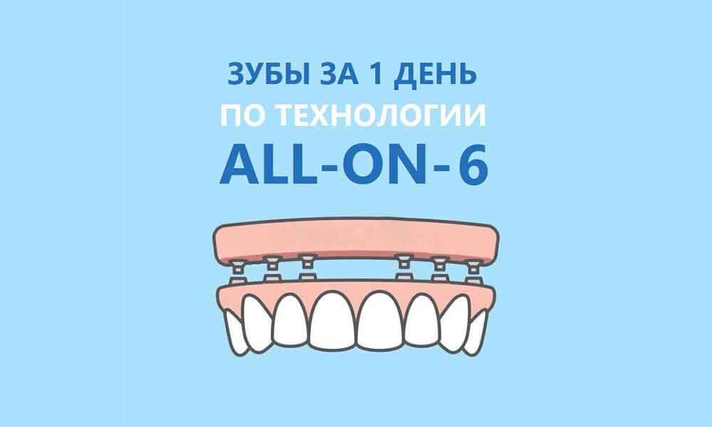 Вставить зубы в чите. Зубы за 1 день по технологии all-on-4. зубы за 1 день импланты.