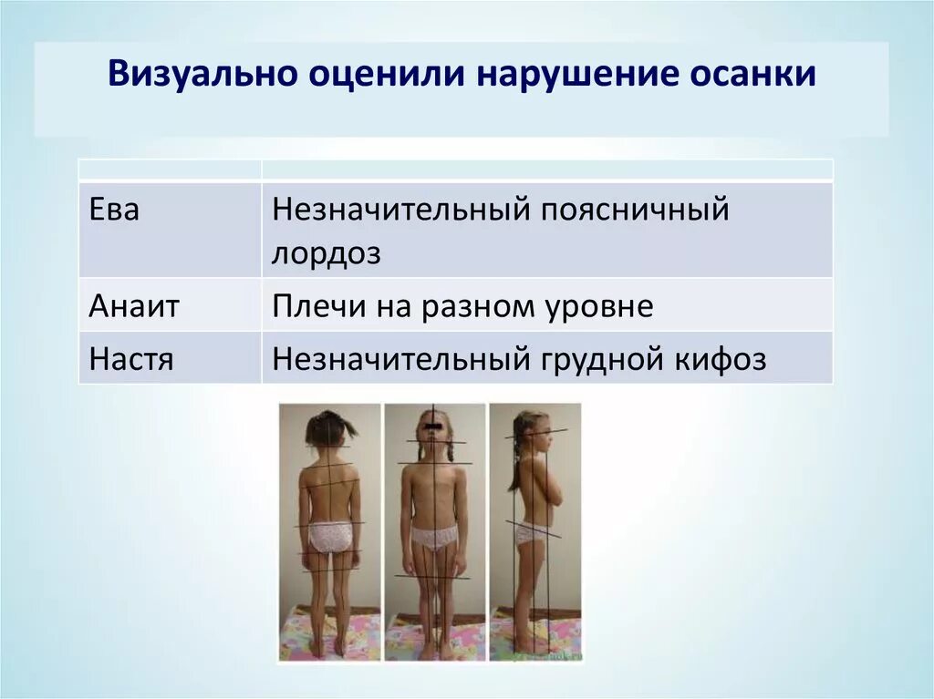 Нарушение осанки код. Нарушение осанки по мкф. нарушение осанки мкб у детей. нарушение осанки код мкб 10 у детей.