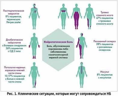 Постгерпетическая невралгия симптомы