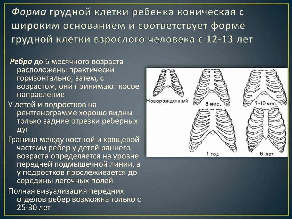 Форма грудной клетки у детей 2 года в норме. Форма грудной клетки у детей. Коническая форма грудной клетки у детей. Форма грудной клетки в норме. Грудная клетка ребенка 2 года