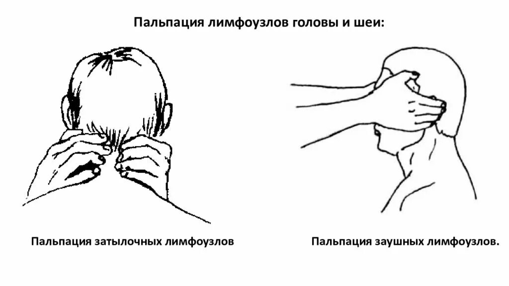 Картинки ЗАТЫЛОЧНЫЕ ЛИМФАТИЧЕСКИЕ УЗЛЫ БОЛЯТ